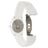 Side view of Rado men's watch